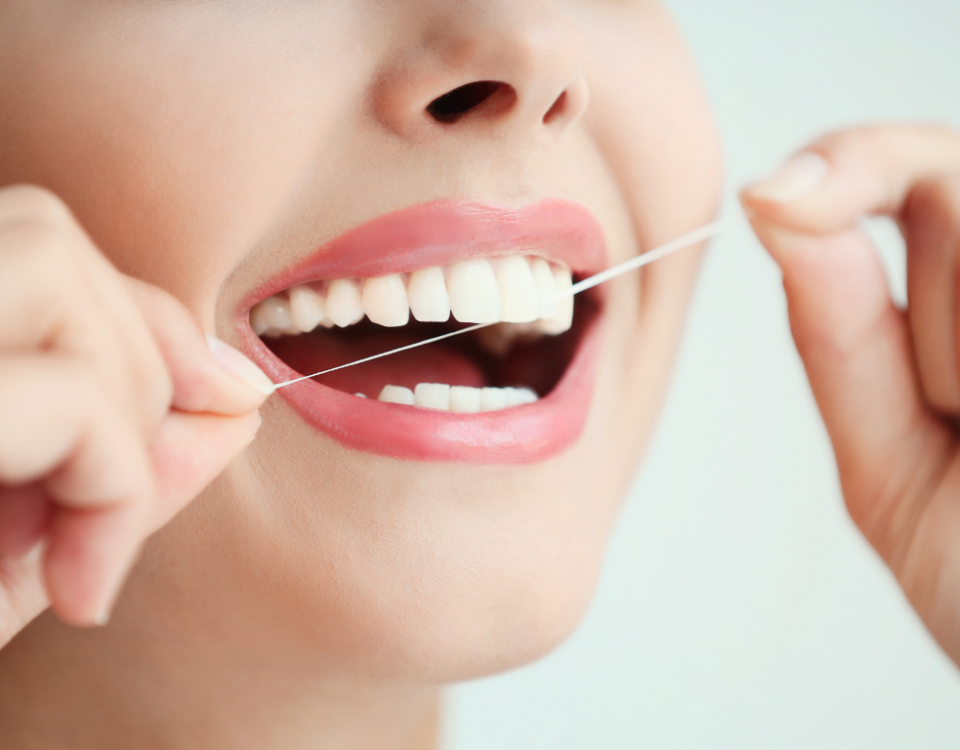 why is important to keep your teeth clean